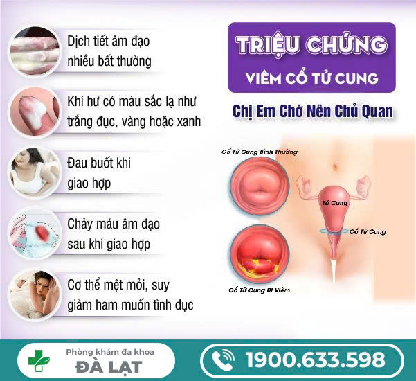 Hình ảnh minh họa